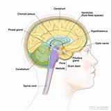 Photos of Brain Tumors Located Near Pituitary Gland