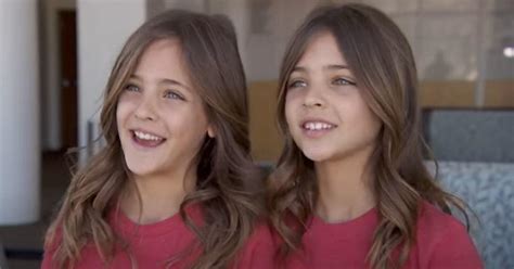 girls dubbed ‘world s most beautiful twins are now the most gorgeous