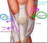 Photos of Knee Injury Quad Pain