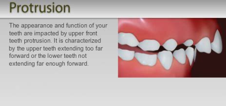 common dental problems gamache orthodontics