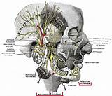 Images of Zygomatic Nerve Damage