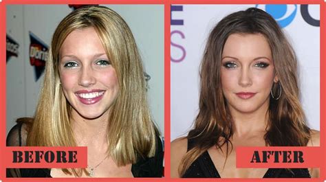katie cassidy plastic surgery before after celebrity bad plastics surgery