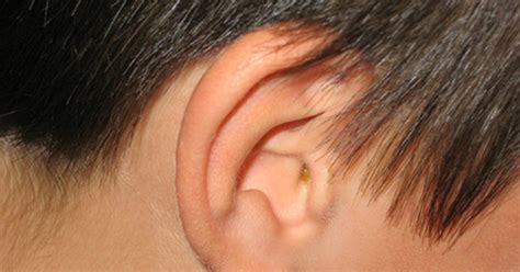 prevent ear wax build  livestrongcom