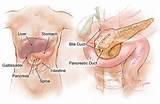 Symptoms Of Pancreatic Tumor