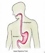 Images of Medical Conditions Of The Esophagus