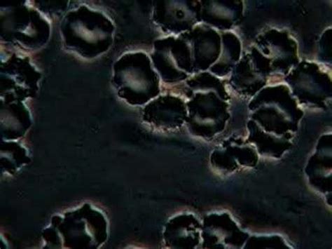 cell wall deficient bacteria youtube