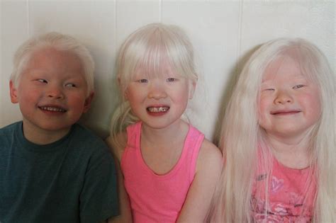 asian albinos google search beautiful asian beautiful women lovely african nations human