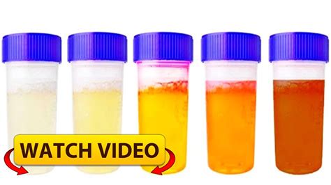notice  urine color   lot   health     color means youtube