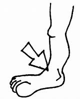 Ankle Clipart Body Coloring Cliparts Back Drawing Chin Clip Parts Pages Line Drawings Human Outline Broken Sprain Edupics Sprained Library sketch template