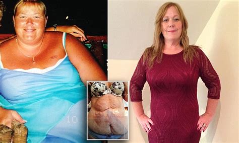 Obese Nurse Karen Smith Spends £20 000 To Get Her Sex Life Back Daily
