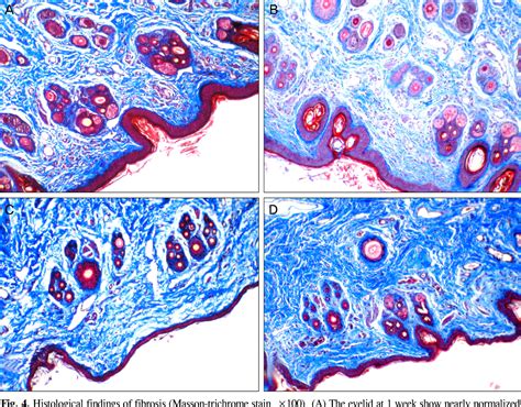 figure    comparison   octyl cyanoacrylate adhesives