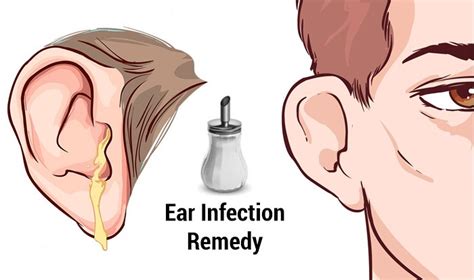 Home Remedies For Ear Infections Top 10 Home Remedies
