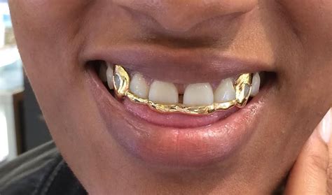 gold overlay removable gold teeth grillz  myfamillystore