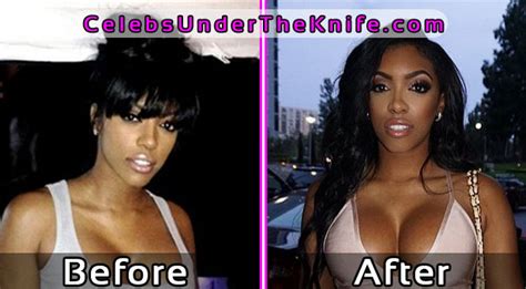 Porsha Williams Photos Before And After Plastic Surgery