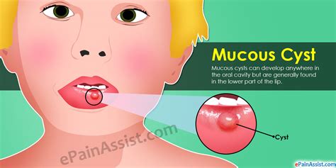 mucous in mouth porn website name