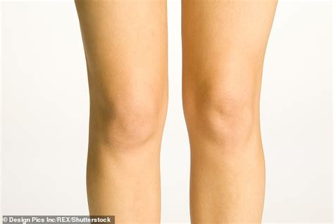 One Stop Operation Straightens Wonky Knees In Theatre So Patients Can