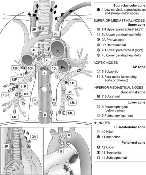 Lung Cancer Staging Nodal Stations Lung Cancer Staging The Noninvasive