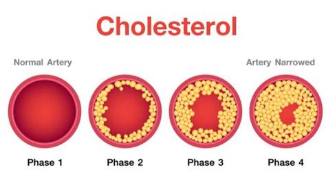 obat kolesterol mosehat terpercaya   kelebihan