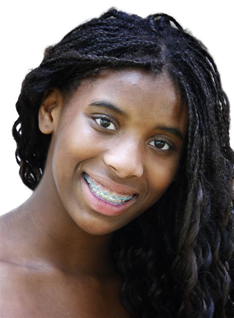 beautiful african american teenage girl  brace dudley smiles orthodontics