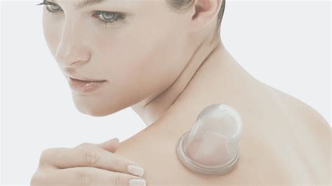 7 reasons why we love cupping therapy holistic health