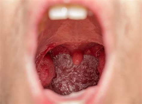 holes in the throat porn hub sex