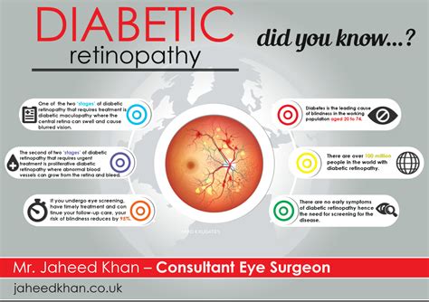 diabetic retinopathy    jaheed khan