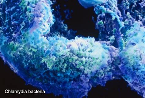 chlamydia picture image  medicinenetcom