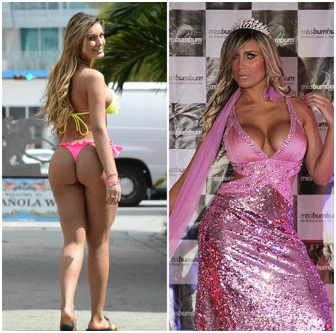 Miss Bumbum Runner Up Ill In Hospital After Thigh