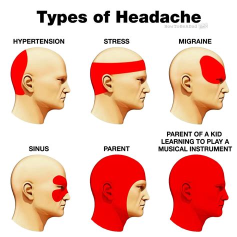pin by howtobeadad on diagramatic headache types