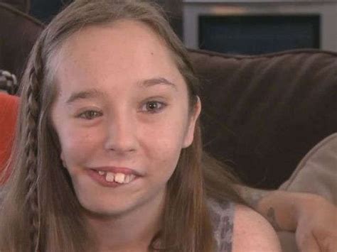 Teen With Facial Deformity Finds Reason To Smile Inspiration News