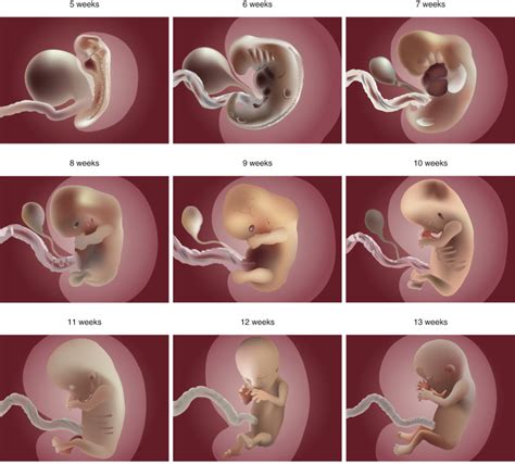 Evaluation Of Fetal Anatomy In The First Trimester Radiology Key