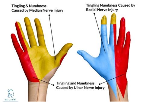 Ulnar Nerve Course Motor Sensory And Common Injuries How