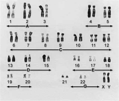 image chromosomes msd manual consumer version