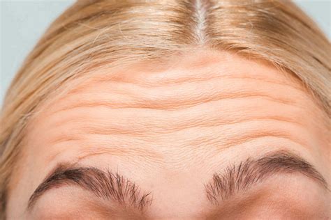 understanding   types  wrinkles reviva labs