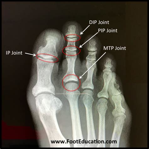 bones  joints   foot  ankle overview footeducation