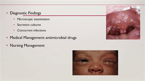 Sexually Transmitted Infections Youtube