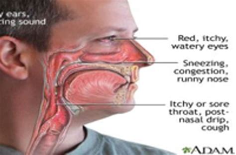chronic mucus in throat coughing bronchitis contagious