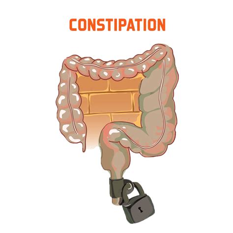 constipation treatment coimbatore remedy constipation hospital