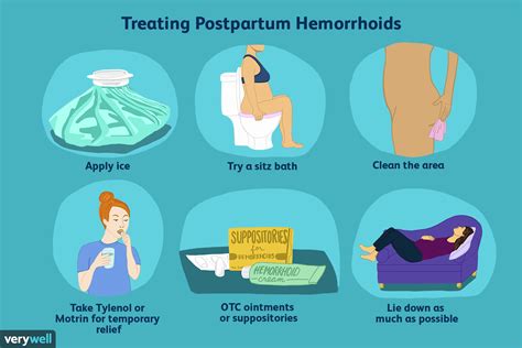Postpartum Hemorrhoids Symptoms Causes Treatments