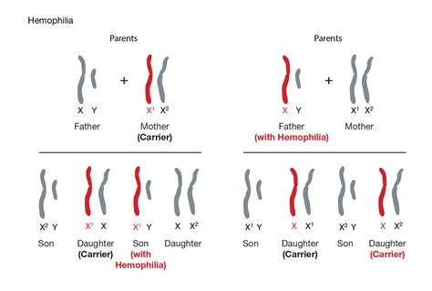 hemophilia