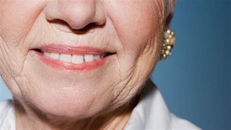 beauty tips  facial wrinkles  dynamic  static