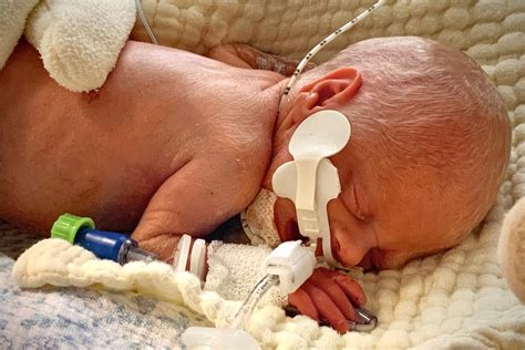 fundraiser by kirsty thomas little lili s fight for survival in nicu
