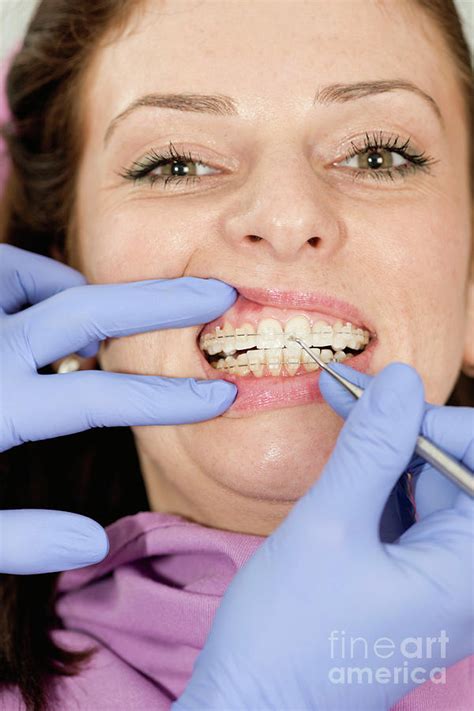 Orthodontist Tightening Braces Photograph By Microgen Images Science