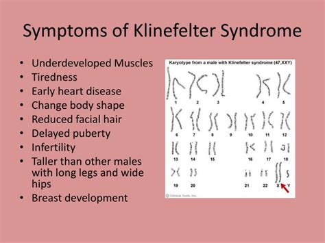 Ppt Klinefelter Syndrome Powerpoint Presentation Id 6730570
