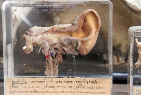 1000 Images About Preserved Human Specimens On Pinterest