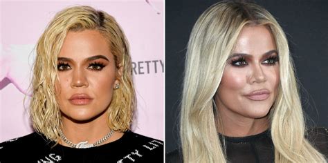 did khloé kardashian get a nose job before after photos and the truth