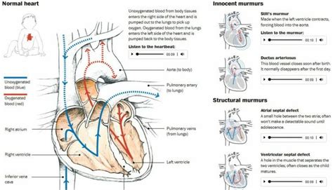 Interactive Inspiration [45] Visualoop Heart Murmur