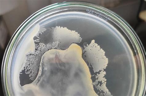 bacillus genus bacteria colonies stock image image  microorganisms