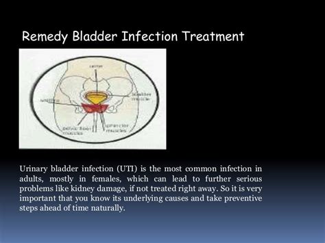Bladder Infection Treatment