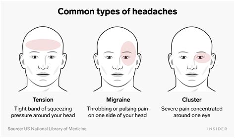 types  headaches  types  headaches